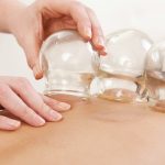 Die Schröpfmassage ist eine intensive, klassische Massagetechnik.